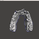 舌侧3D数字口腔系统