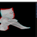 医学图像三维重建红蓝3D仿真程序