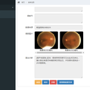 智慧眼病诊断系统