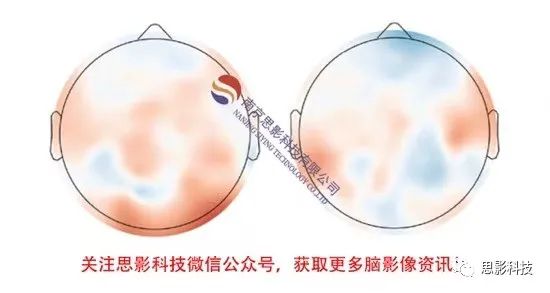 思影科技 第二十八届脑电数据处理中级班 北京 6 20 25 技术圈