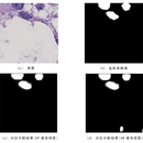 基于Mask R-CNN的癌细胞核实例分割系统