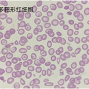 基于数字图像处理方法的医学图像红细胞计数器