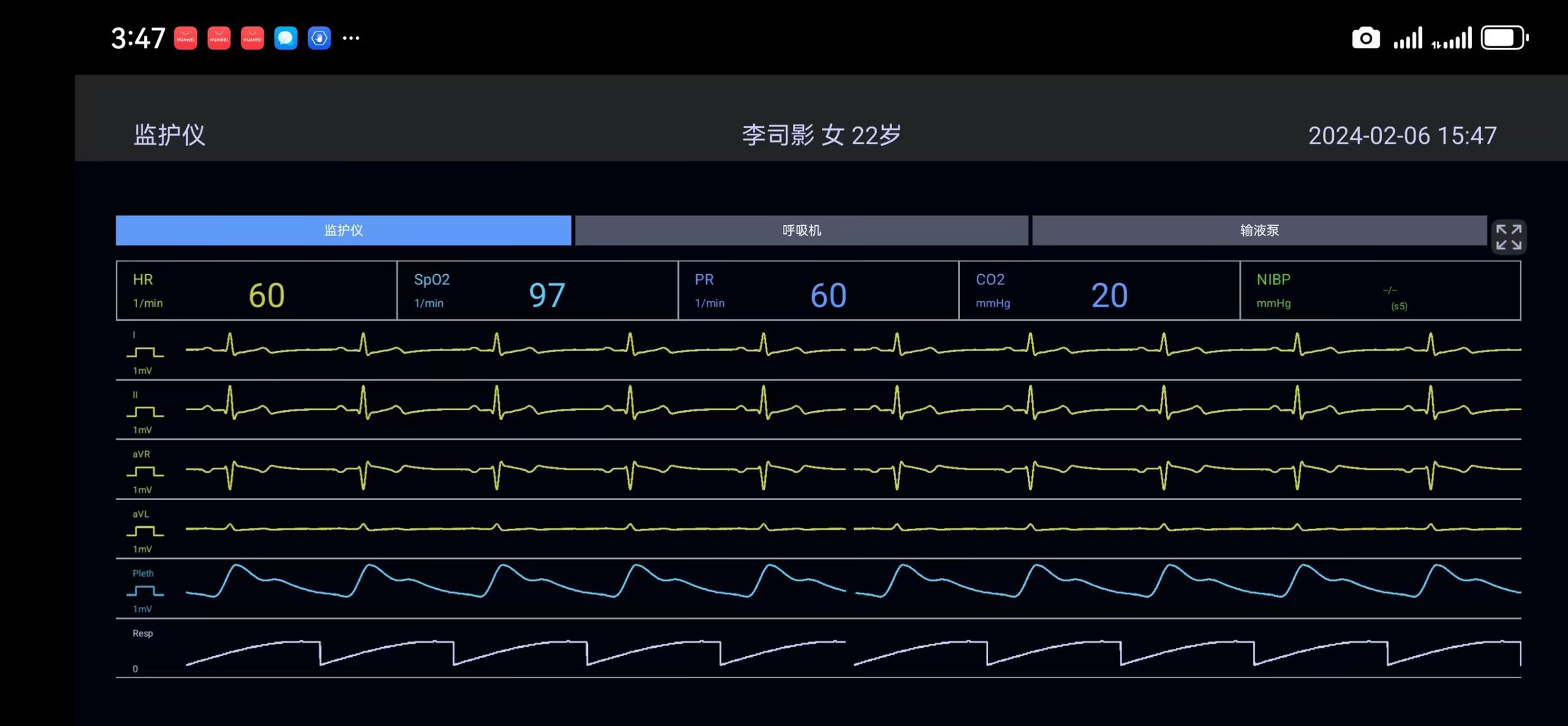 链接图片