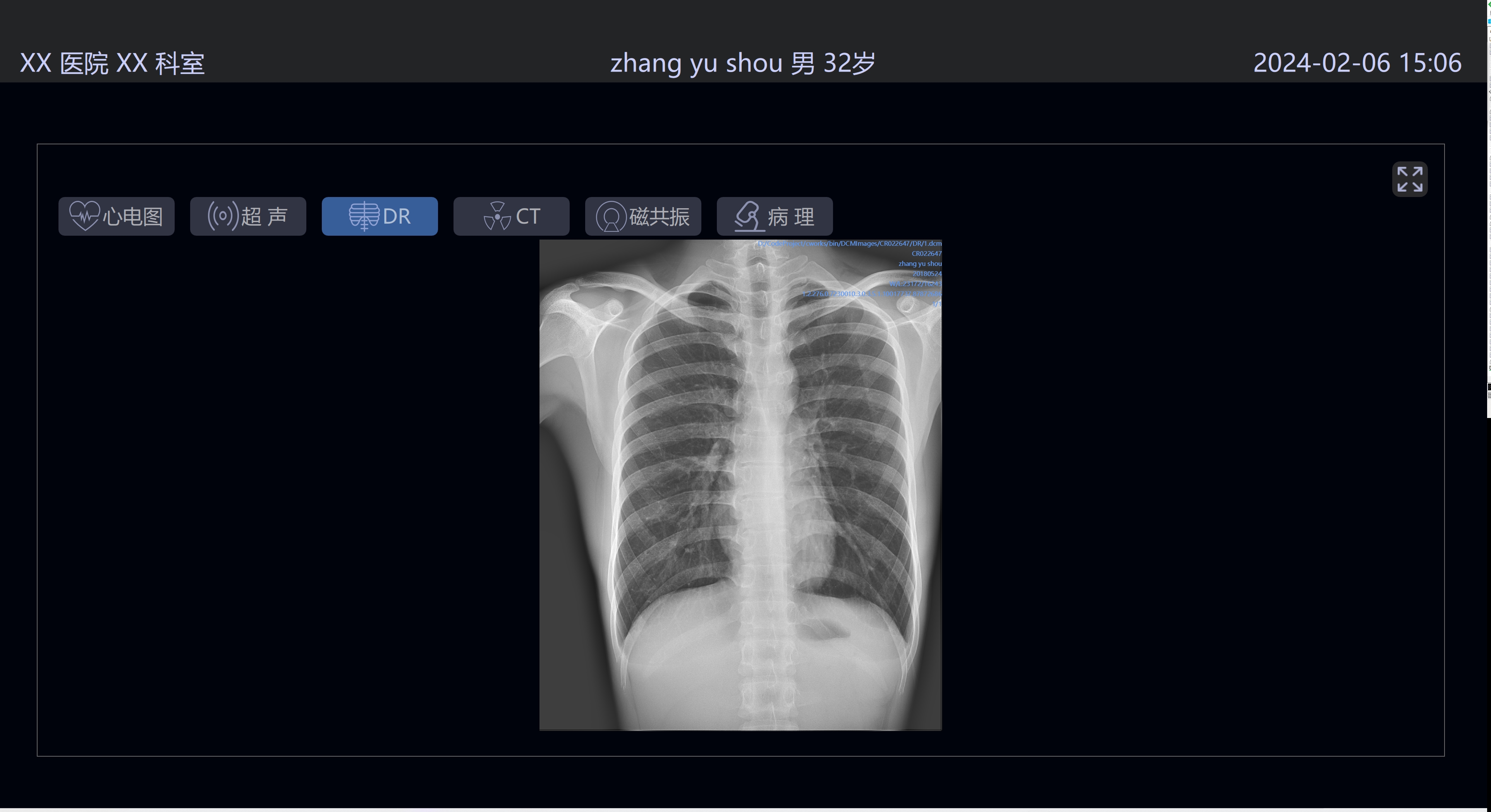 动态图片