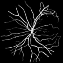 眼底血管图像分割算法设计