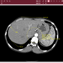 DICOM Viewer——医学影像文件的在线预览工具