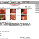 内窥镜图文报告信息系统