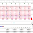 心电数据分析软件