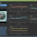 Perterm Infant Movement Recognition System