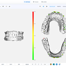 TMJ颞下颌关节诊治系统