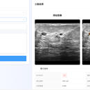 基于 VMamba 与频域特征金字塔的乳腺超声病灶智能分割与辅助诊断系统