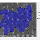 晶体计数、计算面积